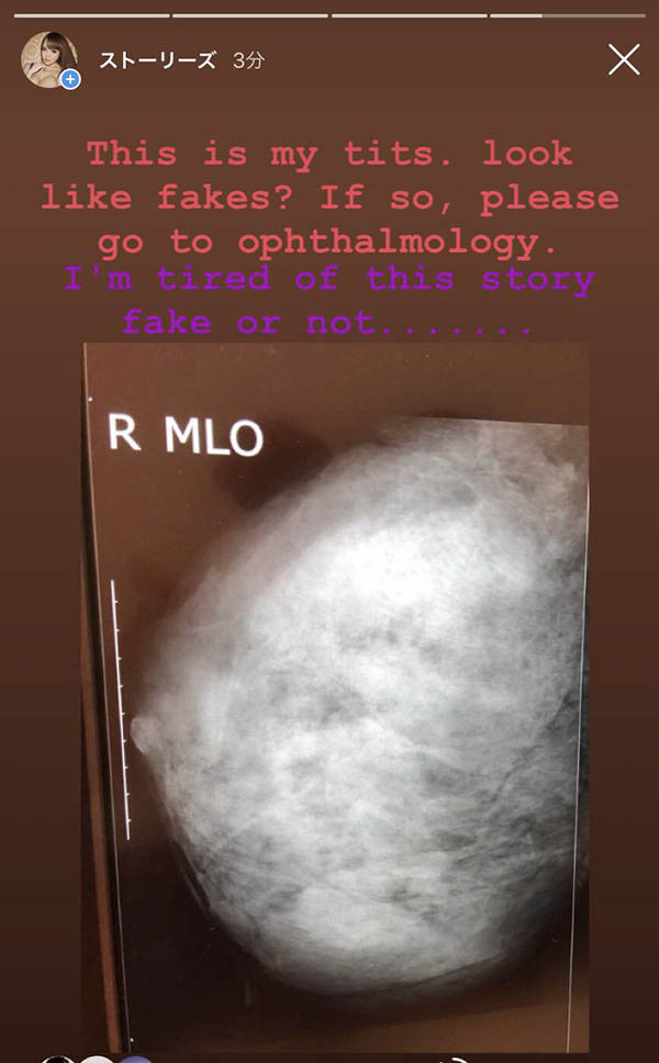 最新推荐！AV第一乳霸《Hitomi》精选作品介绍……