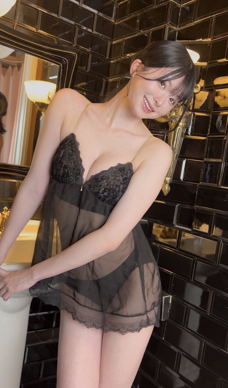 变成独眼龙！松本丽铃(原 明日见未来)被前男友打到受伤