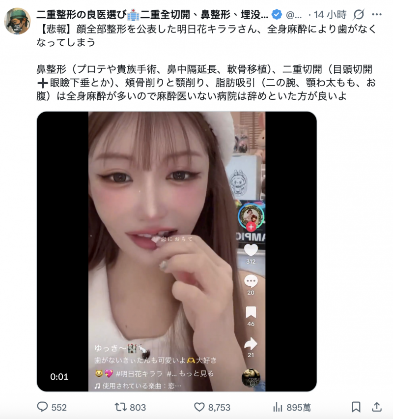 贺年少了一颗牙！明日花キララ(明日花绮罗)怎么变这样？